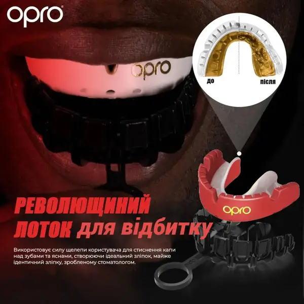 Капа OPRO Gold Braces под брекеты взрослая (возраст 11+) Red/Pearl (art.102506003) купить недорого в Украине, фото 2